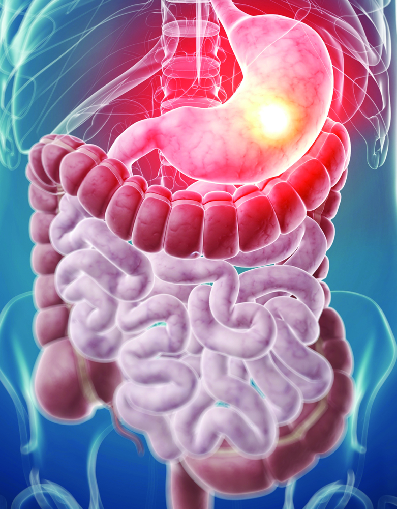 Enteric Formulations